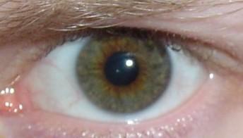 my eye!